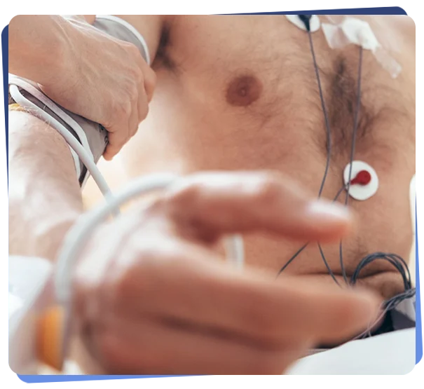 ECG
