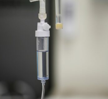 Intravenous saline bag and drip chamber used for iron infusions