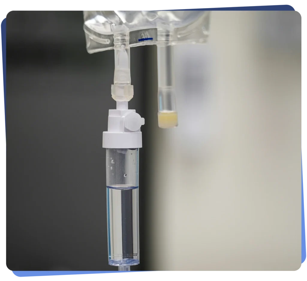 Intravenous saline bag and drip chamber used for iron infusions